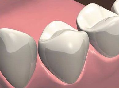 3-etap-implantacii-zuba